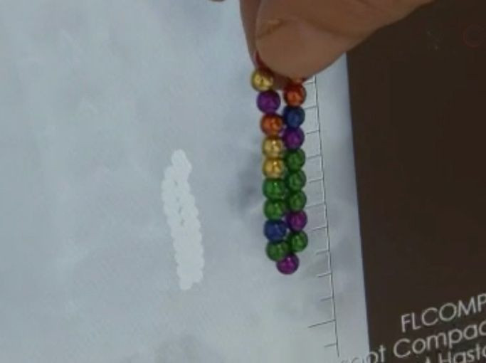 Karın ağrısıyla hastaneye götürdüler çocuğun midesinden çıkanlar hayret verici! - Resim: 2