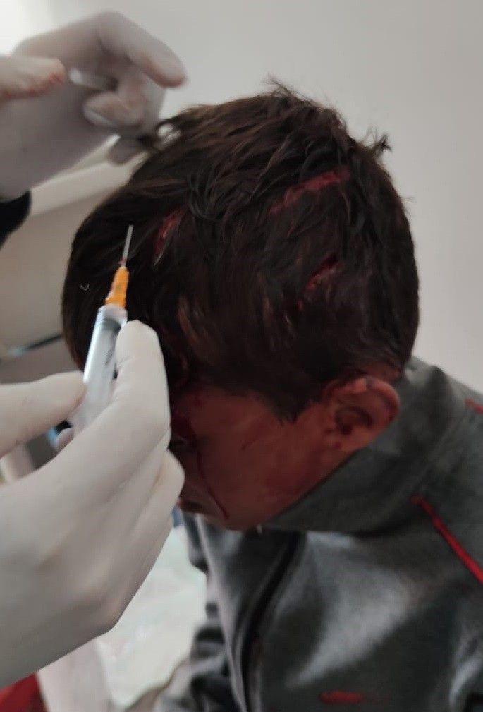 Van'da oğlunun öldüresiye dövdüğü çocuğu hastaneye götürdü: Kayalıklardan düşmüş - Resim: 3