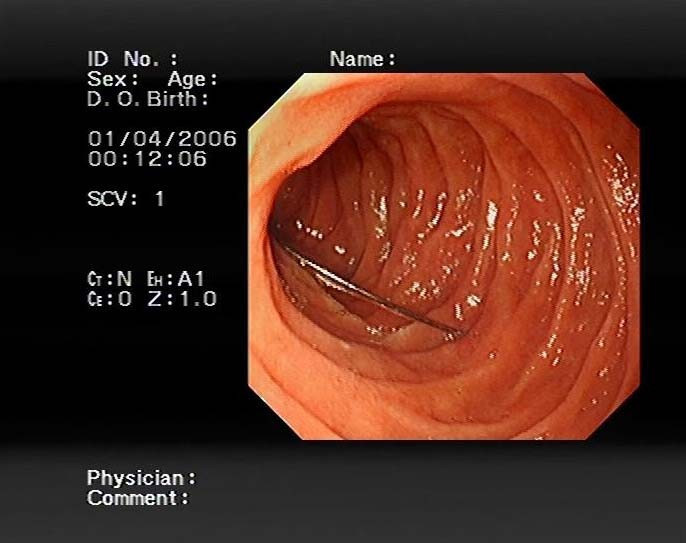 Kediden korktu 15 iğneyi birden yuttu - Resim: 3