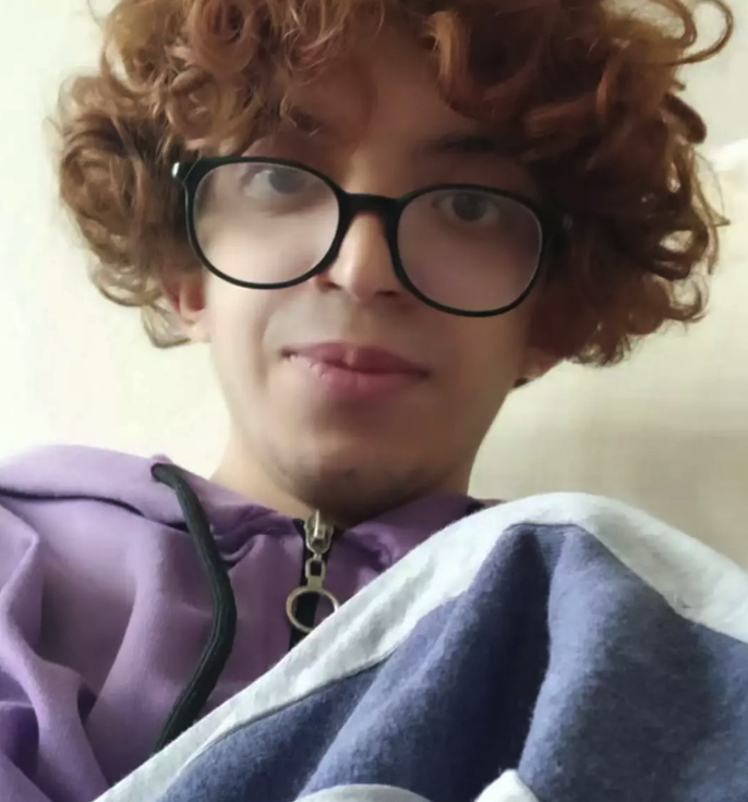 'Tablet Reis' adıyla tanınan Onurcan Güzel 5 ayrı yüz ameliyatı oldu, tanınmaz hale geldi! - Resim: 2