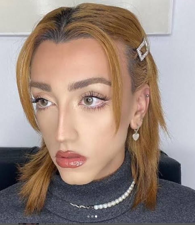 Instagram fenomeni Mika Can Raun estetik operasyon geçirdi Mika Raun kimdir işte son hali - Resim: 2