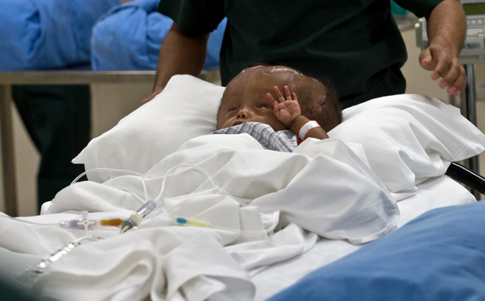 İkinci ameliyat da başarılı geçti... - Resim: 1