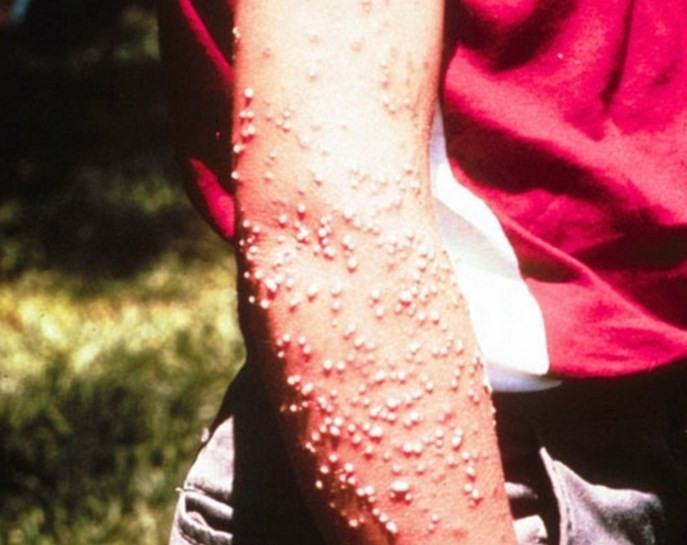 Ülke ekonomisine balta vuruyorlar Avustralya'da ortaya çıktı - Resim: 1