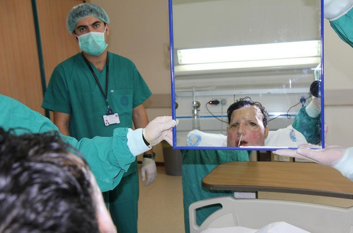 Recep Sert ilk kez yeni yüzüyle tanıştı - Resim: 2