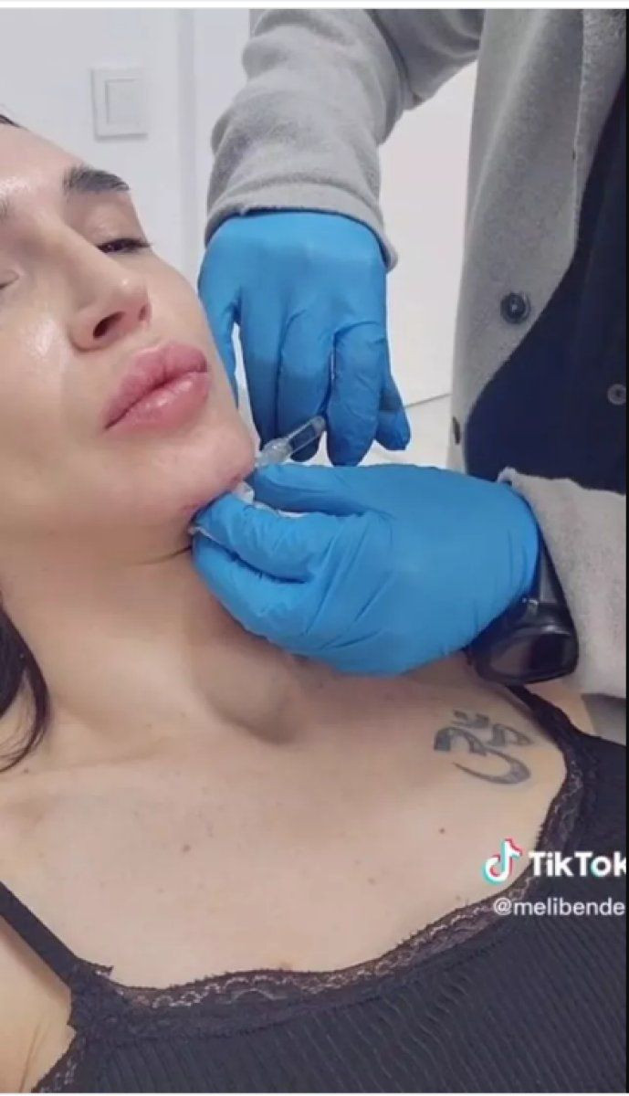 Çukur'un Timsah Celil'i cinsiyet değiştirmişti dolgu yaptırdığı anları paylaştı - Resim: 3