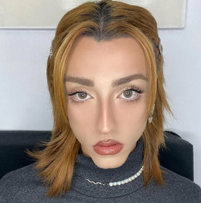 Fenomen Mika Raun çıldırdı, isyan etti! Eteğini kaldırarak seslendi, sosyal medya çalkalandı - Resim: 2