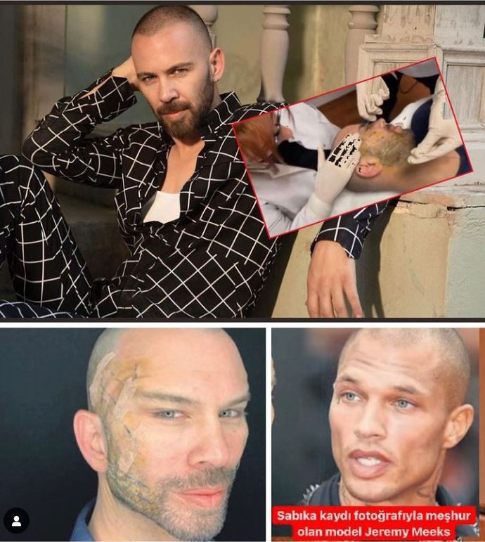 Berksan'ın son hali inanılmaz estetik ameliyat geçirdi! Jeremy Meeks'in kopyası! - Resim: 2