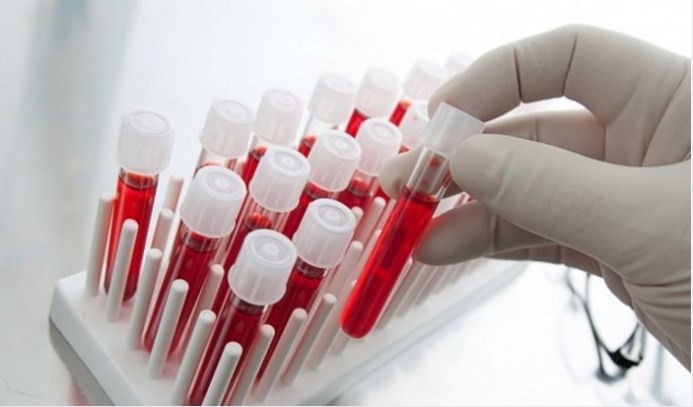 En şanslı kan grubu hangisi? - Resim: 3