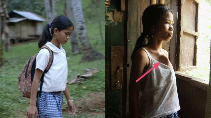 Vücudunda bir vücutla daha doğdu korkup kaçıyorlar! - Resim: 1