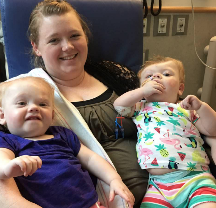 Bu halde doğdular doktorları bile şaşkına çevirdiler daha sonra da ... - Resim: 4