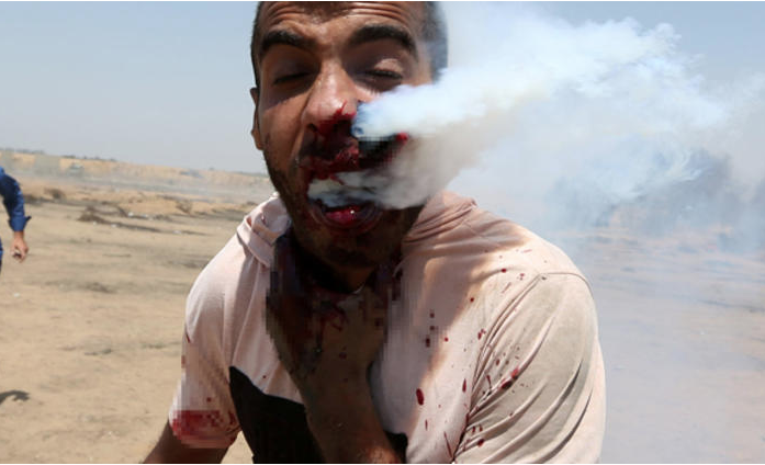 Korkunç görüntüler! 100'den fazla yaralı var - Resim: 1