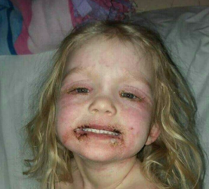 Eve geldi 3 yaşındaki kızını bu halde buldu gerçekler şoke etti - Resim: 1