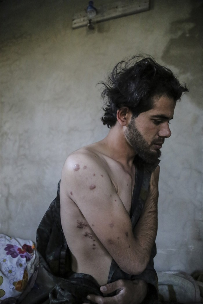 83 şarapnel parçasıyla yaşayan Türkmen komutan konuştu - Resim: 2