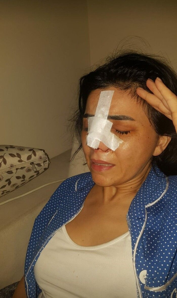 İstanbul'da aynaya bakmak istemiyor dokununca sarkıp katlanıyor! Gece açık şekilde... - Resim: 2