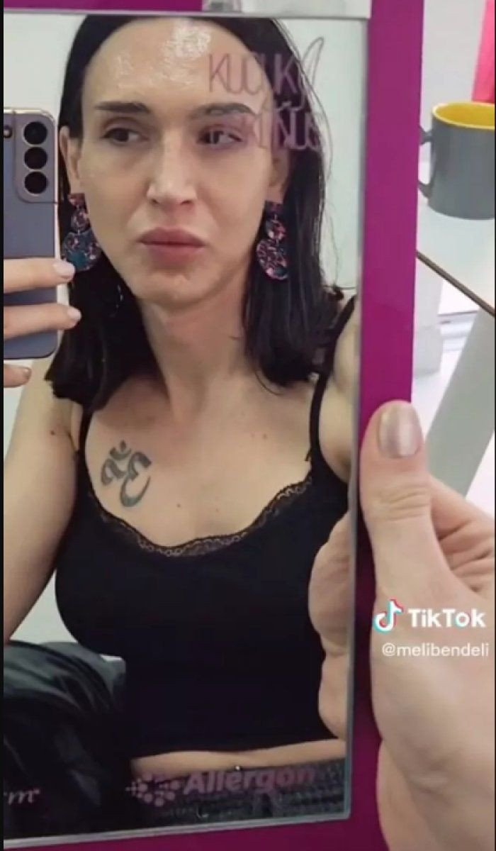 Çukur'un Timsah Celil'i cinsiyet değiştirmişti dolgu yaptırdığı anları paylaştı - Resim: 2