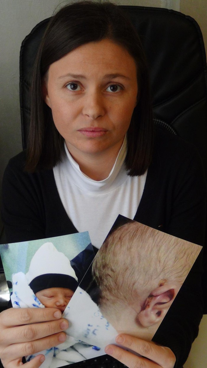 Yeni doğan bebeğin kulağı koptu aile şokta - Resim: 3