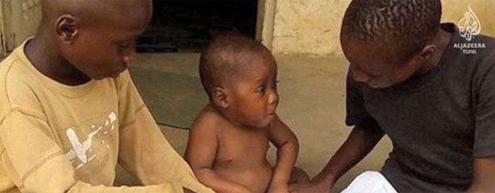 Çadılıkla suçlanan çocuğu hatırladınız mı? - Resim: 4