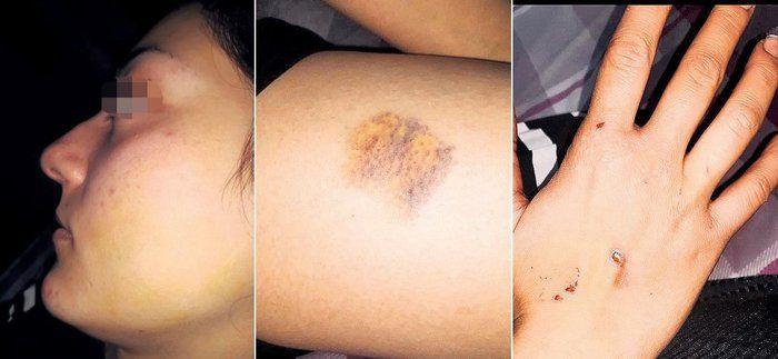 Yeni evli kadına kocası kabusu yaşattı! Dövüp vücudunda sigara söndürdü - Resim: 3