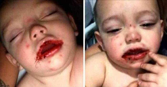 Çocuğunu bir anda bu halde buldu hastaneye koştu gerçekler acı! - Resim: 1