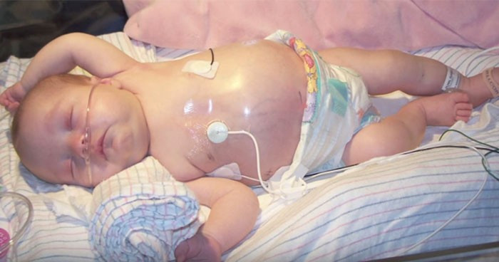 Doktor bebeğin karnındaki şişliği fark etti ve şoke oldu - Resim: 2