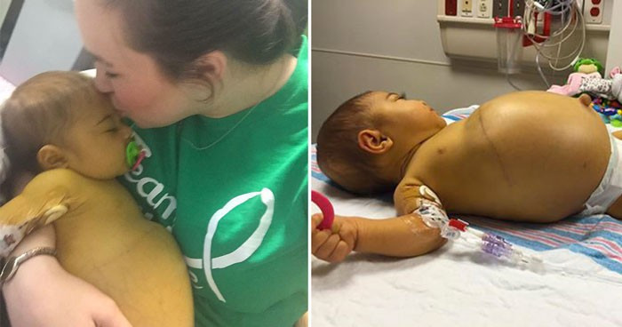 Bebeğin karnı her gün şişmeye başladı aile gerçeği sonradan öğrendi - Resim: 1