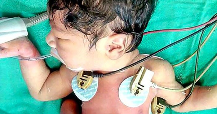 Bebek bu halde doğdu ailesi onu korkunç şekilde öldürmek istedi  - Resim: 1