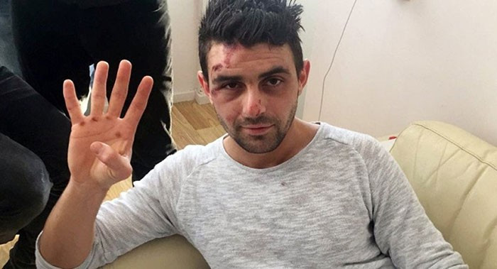 Hüseyin Kurt'u sadece köpekler ısırmamış! Kalın dehşeti anlattı - Resim: 3