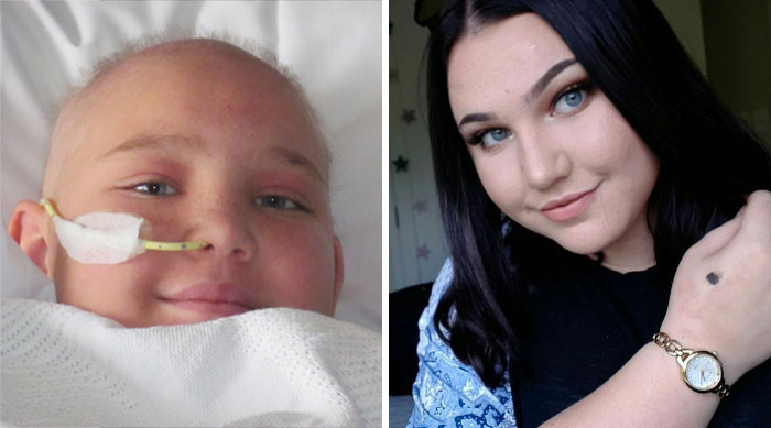 Muhteşem değişim! Onu bir de şimdi görün - Resim: 1