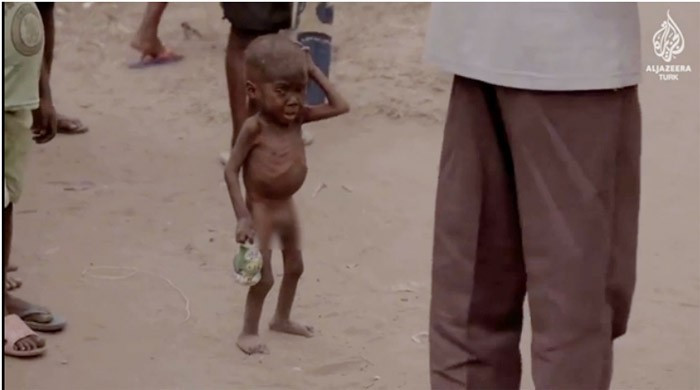 Çadılıkla suçlanan çocuğu hatırladınız mı? - Resim: 2