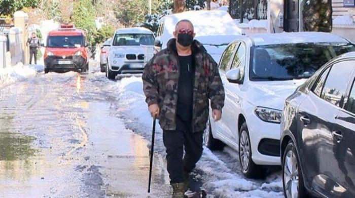 Bastonlu Cem Yılmaz'ı görenler şaşırdı yıllardır aynı hastalığı çekiyor - Resim: 4