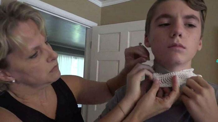 Onu arkadaşlar bir şaka uğruna bu hale getirdi sebebi ise korkunç - Resim: 2