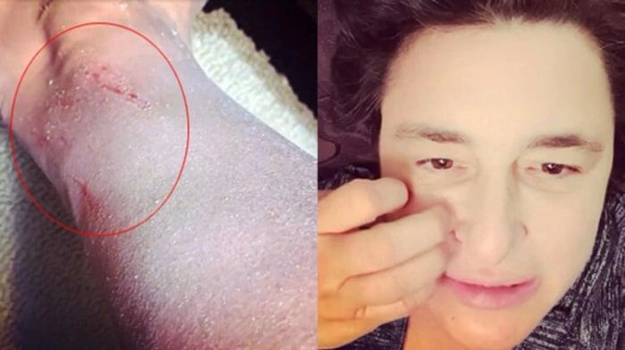 Esra Dermancıoğlu'nun hastalığı korkuttu atak gelince vücudunu kanatana kadar... - Resim: 3