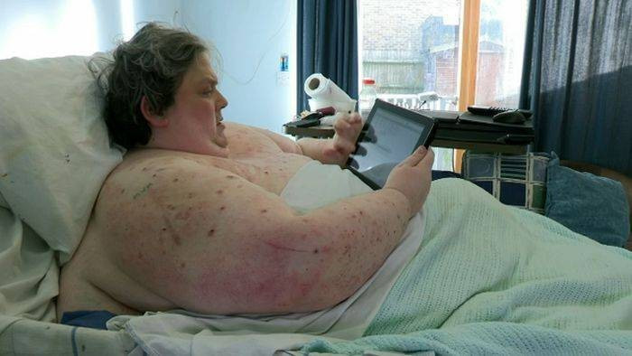 30 yaşına kadar yaşamazsın denilince...  - Resim: 4