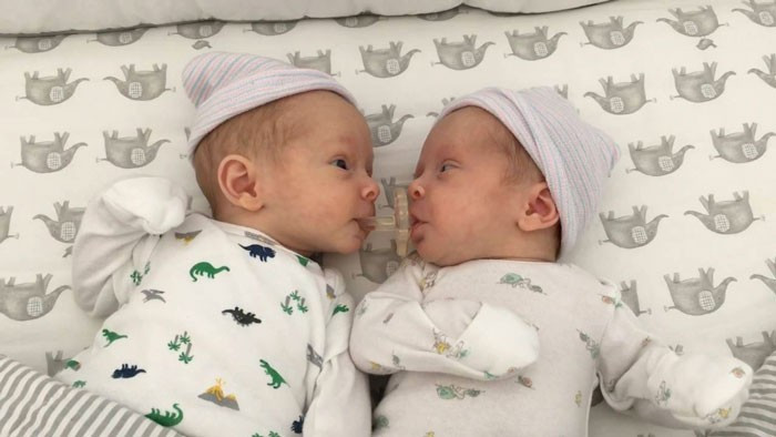 Bebeğin yanına yaklaştılar ama ağızları açık kaldı bakın neden  - Resim: 3