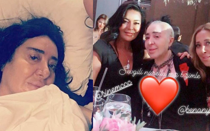 Nur Yerlitaş peruğu çıkarınca son hali ortaya çıktı işte o görüntüsü - Resim: 2