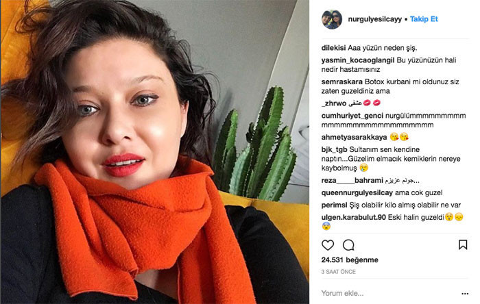 Nurgül Yeşilçay da kendine kıydı! Görenler şok oldu... - Resim: 3