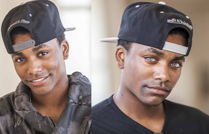 Göz rengi değiştirme ameliyatı az daha kör ediyordu - Resim: 3