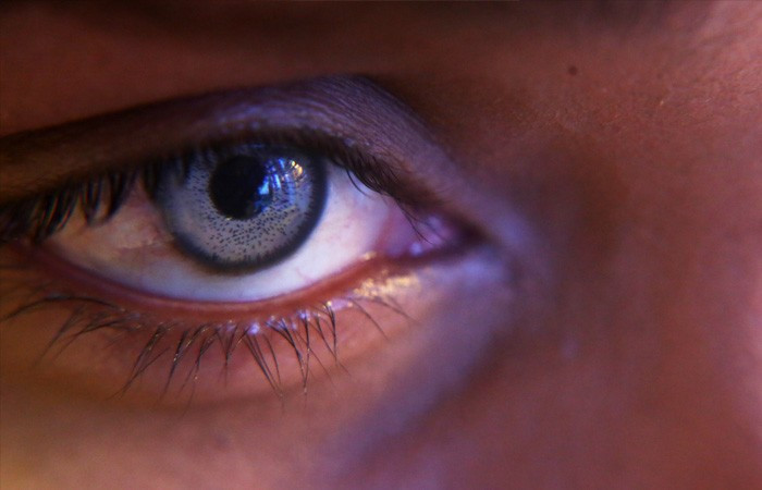 Göz rengi değiştirme ameliyatı az daha kör ediyordu - Resim: 4