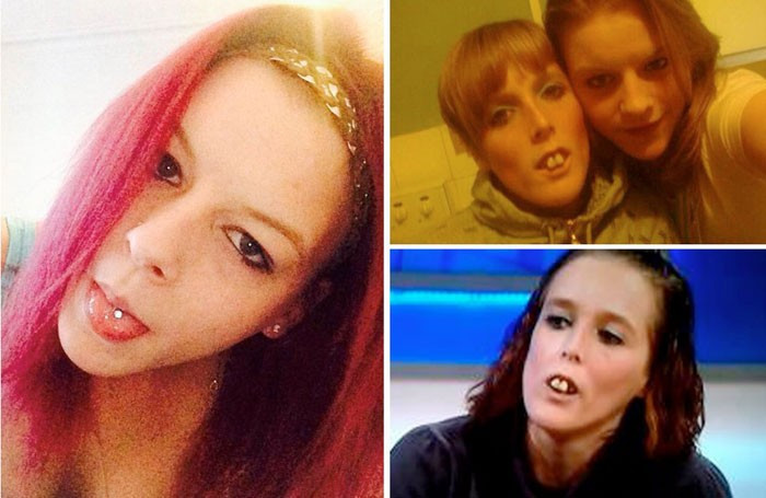 Dişleri alay konusu olunca bakın ne yaptı - Resim: 3