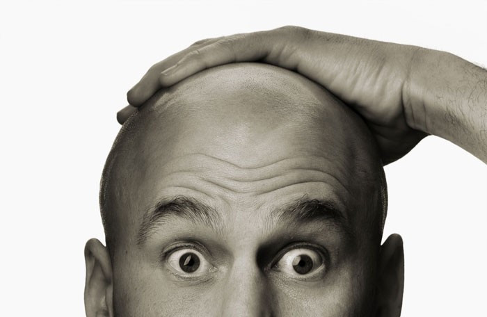 Ülkedeki kelleri tek tek öldürmeye başladılar! Polis alarm verdi - Resim: 4