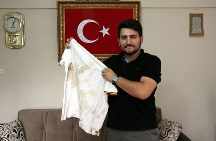 15 Temmuz'dan beri vücundunda 20 şarapnel parçası var! - Resim: 4