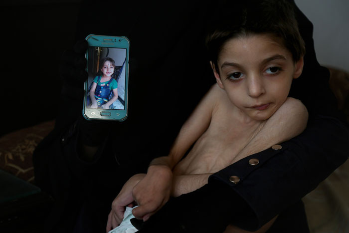 Esed zulmü tavan yaptı! Çocuklar açlıktan ölüyor! - Resim: 1