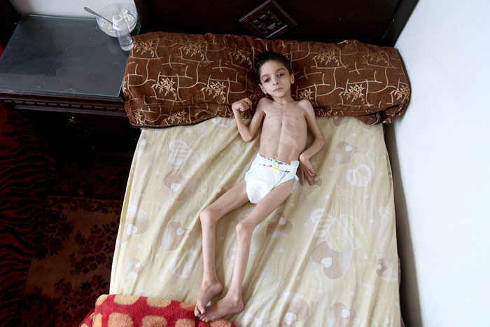 Esed zulmü tavan yaptı! Çocuklar açlıktan ölüyor! - Resim: 2