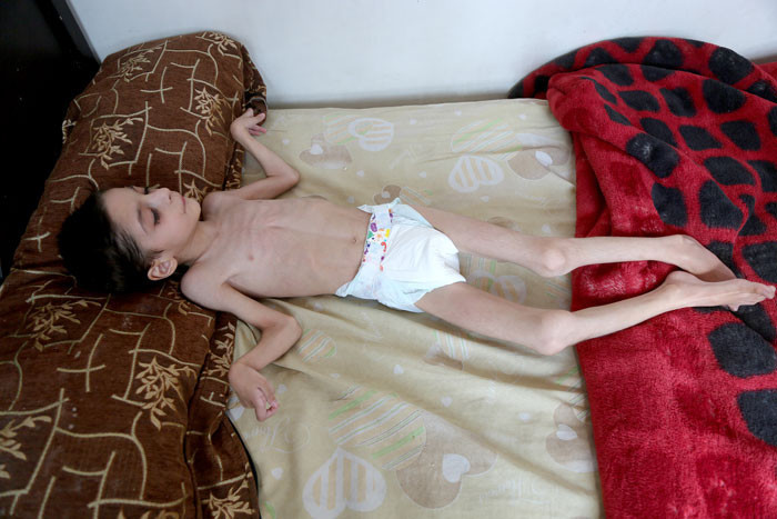 Esed zulmü tavan yaptı! Çocuklar açlıktan ölüyor! - Resim: 4