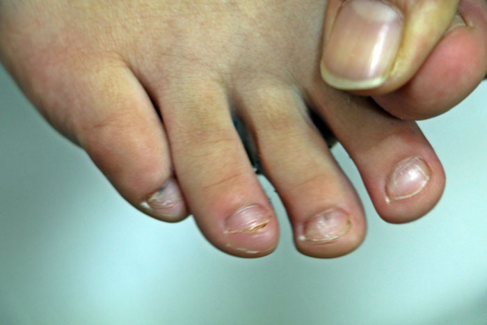 Antalya'da korkunç iddia! 5 yaşındaki çocuğa kreşte dayak... - Resim: 3