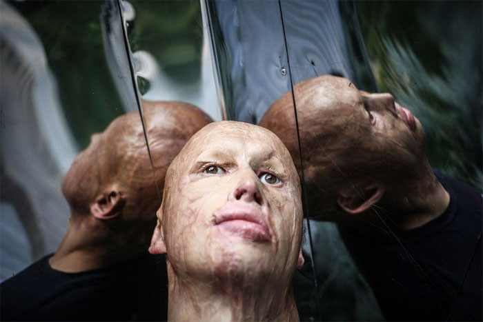 Babası yanan odun fırınının içine attı kardeşi öldü kendisi işte bu halde - Resim: 2