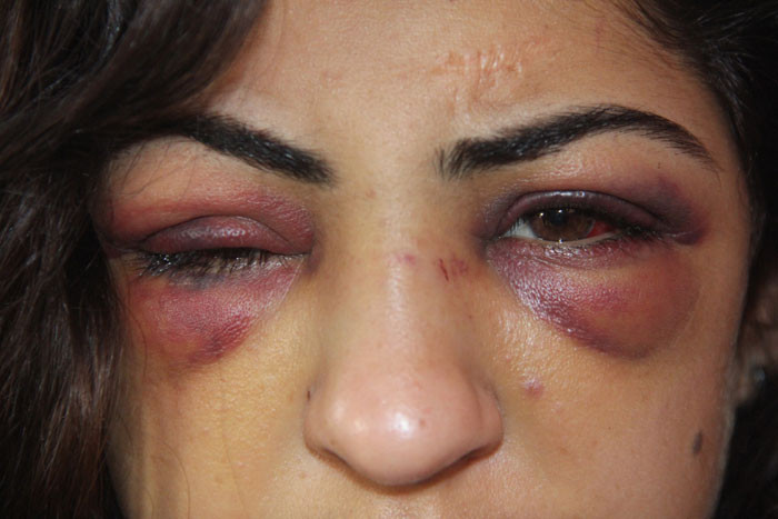 Kuma getirince evi terkeden eşini sokakta yarım saat dövdü - Resim: 2