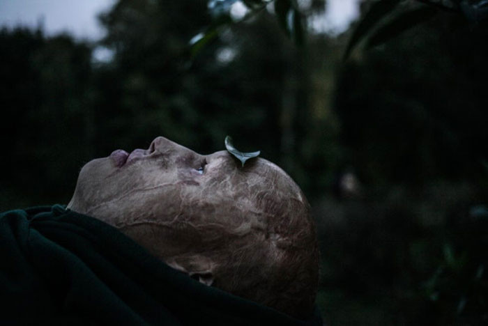 Babası yanan odun fırınının içine attı kardeşi öldü kendisi işte bu halde - Resim: 4