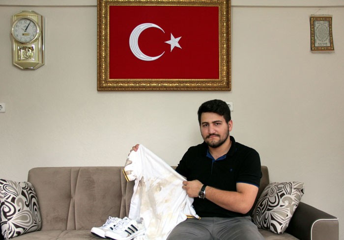 15 Temmuz'dan beri vücundunda 20 şarapnel parçası var! - Resim: 3