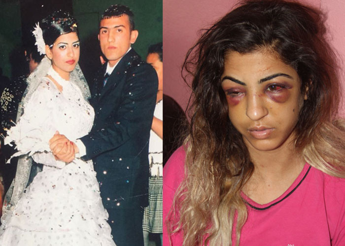 Kuma getirince evi terkeden eşini sokakta yarım saat dövdü - Resim: 1